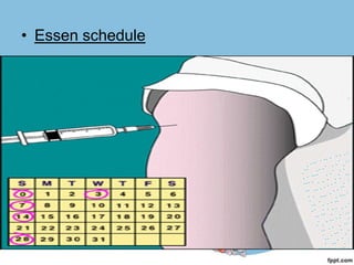 • Essen schedule




• First 3 doses to be given at correct date
• Dose-1/0.5 ml in deltoid
• Stopped after 3 doses if bitten animal remain
  asymptomatic after 10 days
 