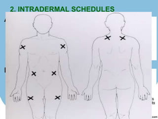 2. INTRADERMAL SCHEDULES
A)




B)
 