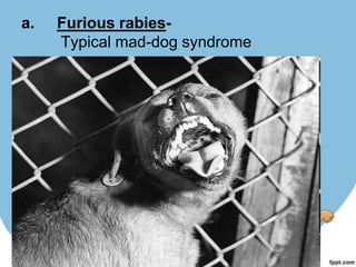 a.   Furious rabies-
     Typical mad-dog syndrome

i. Change in behavior.
ii. Running amuck.
iii. Change in voice due to paralysis of
     laryngeal muscles.
iv. Excessive salivation & foaming at the
     angle of the mouth.
v. Paralytic stage
 