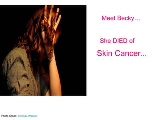 Photo Credit:  Thomas Wasper Meet Becky… She DIED of  Skin Cancer … 