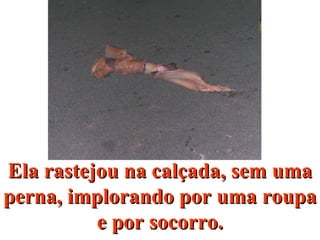 Ela rastejou na calçada, sem umaEla rastejou na calçada, sem uma
perna, implorando por uma roupaperna, implorando por uma roupa
e por socorro.e por socorro.
 