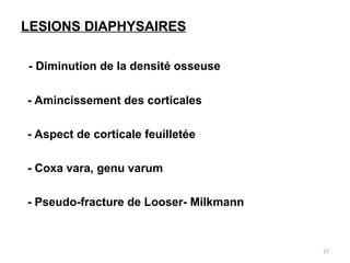 LESIONS DIAPHYSAIRES
- Diminution de la densité osseuse
- Amincissement des corticales
- Aspect de corticale feuilletée
- Coxa vara, genu varum
- Pseudo-fracture de Looser- Milkmann
27
 