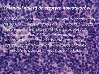 Chłoniaki należą do częstych nowotworów.
W 2006 r. liczba nowych zachorowań w przeliczeniu
na 100 000 mieszkańców Polski wyniosła 13 i była
nieco większa u mężczyzn (14), niż u kobiet (12).
Oznacza to, że ok. 7 500 Polaków każdego roku
zachorowuje na chłoniaki. Wśród najczęściej
występujących nowotworów w Polsce chłoniaki
zajmowały 6. pozycję u mężczyzn i 7. u kobiet.
 