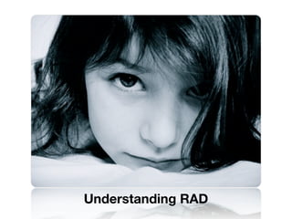 Understanding RAD
 