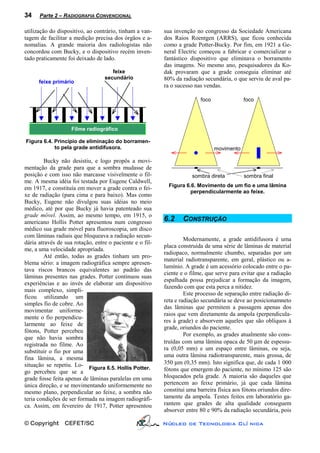 34    Parte 2 – RADIOGRAFIA CONVENCIONAL

utilização do dispositivo, ao contrário, tinham a van-    sua invenção no congresso da Sociedade Americana
tagem de facilitar a medição precisa dos órgãos e a-      dos Raios Roentgen (ARRS), que ficou conhecida
nomalias. A grande maioria dos radiologistas não          como a grade Potter-Bucky. Por fim, em 1921 a Ge-
concordou com Bucky, e o dispositivo recém inven-         neral Electric começou a fabricar e comercializar o
tado praticamente foi deixado de lado.                    fantástico dispositivo que eliminava o borramento
                                                          das imagens. No mesmo ano, pesquisadores da Ko-
                                     feixe                dak provaram que a grade conseguia eliminar até
                                  secundário              80% da radiação secundária, o que serviu de aval pa-
      feixe primário
                                                          ra o sucesso nas vendas.

                                                                         foco               foco




                    Filme radiográfico

Figura 6.4. Princípio de eliminação do borramen-
            to pela grade antidifusora.                                         movimento

        Bucky não desistiu, e logo propôs a movi-
mentação da grade para que a sombra mudasse de
posição e com isso não marcasse visivelmente o fil-                   sombra direta         sombra final
me. A mesma idéia foi testada por Eugene Caldwell,
                                                            Figura 6.6. Movimento de um fio e uma lâmina
em 1917, e constituía em mover a grade contra o fei-
                                                                     perpendicularmente ao feixe.
xe de radiação (para cima e para baixo). Mas como
Bucky, Eugene não divulgou suas idéias no meio
médico, até por que Bucky já havia patenteado sua
grade móvel. Assim, ao mesmo tempo, em 1915, o
americano Hollis Potter apresentou num congresso          6.2     CONSTRUÇÃO
médico sua grade móvel para fluoroscopia, um disco
com lâminas radiais que bloqueava a radiação secun-
                                                                   Modernamente, a grade antidifusora é uma
dária através de sua rotação, entre o paciente e o fil-
                                                          placa construída de uma série de lâminas de material
me, a uma velocidade apropriada.
                                                          radiopaco, normalmente chumbo, separadas por um
        Até então, todas as grades tinham um pro-
                                                          material radiotransparente, em geral, plástico ou a-
blema sério: a imagem radiográfica sempre apresen-
                                                          lumínio. A grade é um acessório colocado entre o pa-
tava riscos brancos equivalentes ao padrão das
                                                          ciente e o filme, que serve para evitar que a radiação
lâminas presentes nas grades. Potter continuou suas
                                                          espalhada possa prejudicar a formação da imagem,
experiências e ao invés de elaborar um dispositivo
                                                          fazendo com que esta perca a nitidez.
mais complexo, simpli-
                                                                   Este processo de separação entre radiação di-
ficou utilizando um
                                                          reta e radiação secundária se deve ao posicionamneto
simples fio de cobre. Ao
                                                          das lâminas que permitem a passagem apenas dos
movimentar uniforme-
                                                          raios que vem diretamente da ampola (perpendicula-
mente o fio perpendicu-
                                                          res à grade) e absorvem aqueles que são oblíquos à
larmente ao feixe de
                                                          grade, oriundos do paciente.
fótons, Potter percebeu
                                                                   Por exemplo, as grades atualmente são cons-
que não havia sombra
registrada no filme. Ao                                   truídas com uma lâmina opaca de 50 µm de espessu-
                                                          ra (0,05 mm) e um espaço entre lâminas, ou seja,
substituir o fio por uma
fina lâmina, a mesma                                      uma outra lâmina radiotransparente, mais grossa, de
situação se repetiu. Lo- Figura 6.5. Hollis Potter.       350 µm (0,35 mm). Isto significa que, de cada 1 000
go percebeu que se a                                      fótons que emergem do paciente, no mínimo 125 são
grade fosse feita apenas de lâminas paralelas em uma      bloqueados pela grade. A maioria são daqueles que
única direção, e se movimentando uniformemente no         pertencem ao feixe primário, já que cada lâmina
mesmo plano, perpendicular ao feixe, a sombra não         constitui uma barreira física aos fótons oriundos dire-
teria condições de ser formada na imagem radiográfi-      tamente da ampola. Testes feitos em laboratório ga-
ca. Assim, em fevereiro de 1917, Potter apresentou        rantem que grades de alta qualidade conseguem
                                                          absorver entre 80 e 90% da radiação secundária, pois

© Copyright      CEFET/SC                                 Núcleo de Tecnologia Clí nica
 