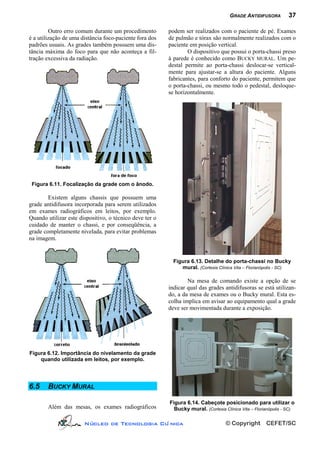 GRADE ANTIDIFUSORA          37

         Outro erro comum durante um procedimento        podem ser realizados com o paciente de pé. Exames
é a utilização de uma distância foco-paciente fora dos   de pulmão e tórax são normalmente realizados com o
padrões usuais. As grades também possuem uma dis-        paciente em posição vertical.
tância máxima do foco para que não aconteça a fil-               O dispositivo que possui o porta-chassi preso
tração excessiva da radiação.                            à parede é conhecido como BUCKY MURAL. Um pe-
                                                         destal permite ao porta-chassi deslocar-se vertical-
                                                         mente para ajustar-se a altura do paciente. Alguns
                                                         fabricantes, para conforto do paciente, permitem que
                                                         o porta-chassi, ou mesmo todo o pedestal, desloque-
                                                         se horizontalmente.




 Figura 6.11. Focalização da grade com o ânodo.

        Existem alguns chassis que possuem uma
grade antidifusora incorporada para serem utilizados
em exames radiográficos em leitos, por exemplo.
Quando utilizar este dispositivo, o técnico deve ter o
cuidado de manter o chassi, e por conseqüência, a
grade completamente nivelada, para evitar problemas
na imagem.


                                                           Figura 6.13. Detalhe do porta-chassi no Bucky
                                                              mural. (Cortesia Clínica Vita – Florianópolis - SC)

                                                                 Na mesa de comando existe a opção de se
                                                         indicar qual das grades antidifusoras se está utilizan-
                                                         do, a da mesa de exames ou o Bucky mural. Esta es-
                                                         colha implica em avisar ao equipamento qual a grade
                                                         deve ser movimentada durante a exposição.




Figura 6.12. Importância do nivelamento da grade
    quando utilizada em leitos, por exemplo.




6.5     BUCKY MURAL

                                                         Figura 6.14. Cabeçote posicionado para utilizar o
        Além das mesas, os exames radiográficos            Bucky mural. (Cortesia Clínica Vita – Florianópolis - SC)

                       Núcleo de Tecnologia Clí nica                               © Copyright        CEFET/SC
 