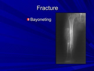 diagnostico por imagen musculo esqueletico | PPT