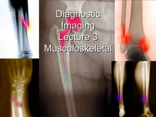 Diagnostic Imaging Lecture 3 Musculoskeletal 