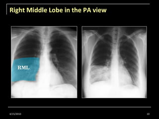 Radiology for Undergraduate Part 1 | PPTX