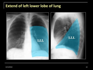 Radiology for Undergraduate Part 1 | PPTX