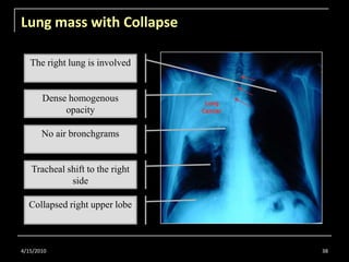 Radiology for Undergraduate Part 1 | PPTX