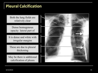 Radiology for Undergraduate Part 1 | PPTX