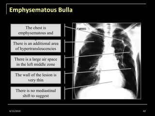 Radiology for Undergraduate Part 1 | PPTX