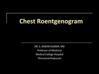 Chest Roentgenogram DR. S. ASWINI KUMAR. MD Professor of Medicine Medical College Hospital Thiruvananthapuram 