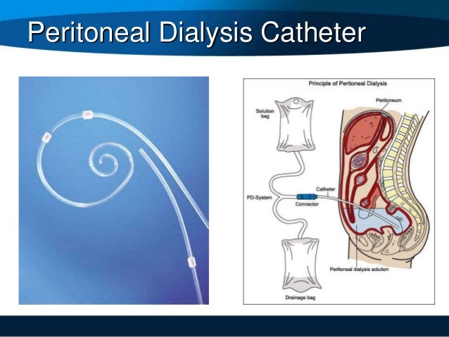 Rad 104 hospital practice and care of patients 8 types of catheters