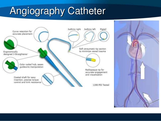 types of catheters