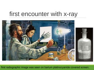 first encounter with x-ray
first radiographic image was seen on barium platinocyanide covered screen.
 