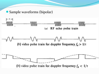 Sample waveforms (bipolar)
 
