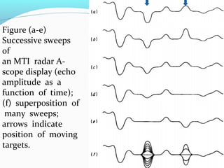 Figure (a-e)
Successive sweeps
of
an MTI radar A-
scope display (echo
amplitude as a
function of time);
(f) superposition of
many sweeps;
arrows indicate
position of moving
targets.
 