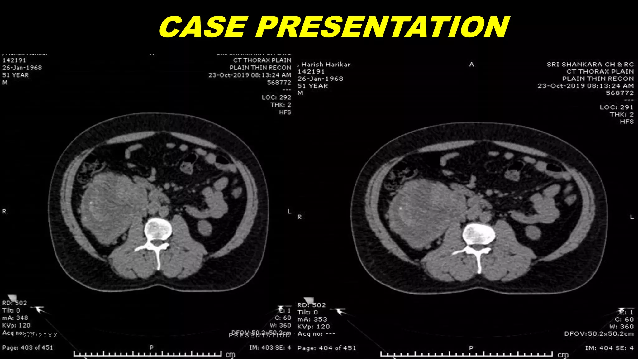 CASE PRESENTATION
 