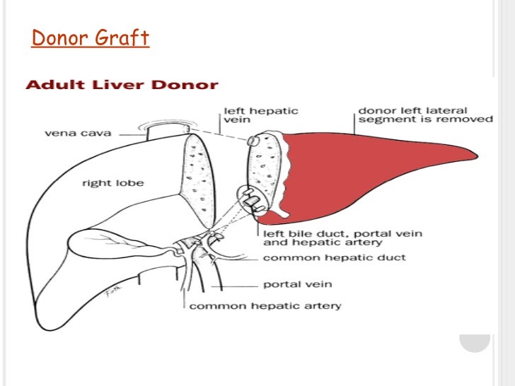 Liver Transplantation present scenario in India