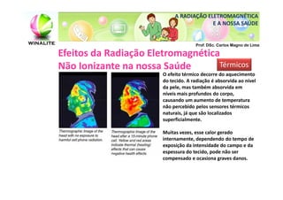 A RADIAÇÃO ELETROMAGNÉTICA
                                         E A NOSSA SAÚDE


                                     Prof. DSc. Carlos Magno de Lima

Efeitos da Radiação Eletromagnética
Não Ionizante na nossa Saúde       Térmicos
                       O efeito térmico decorre do aquecimento
                       do tecido. A radiação é absorvida ao nível
                       da pele, mas também absorvida em
                       níveis mais profundos do corpo,
                       causando um aumento de temperatura
                       não percebido pelos sensores térmicos
                       naturais, já que são localizados
                       superficialmente.

                       Muitas vezes, esse calor gerado
                       internamente, dependendo do tempo de
                       exposição da intensidade do campo e da
                       espessura do tecido, pode não ser
                       compensado e ocasiona graves danos.
 
