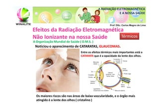 A RADIAÇÃO ELETROMAGNÉTICA
                                                           E A NOSSA SAÚDE


                                                        Prof. DSc. Carlos Magno de Lima

Efeitos da Radiação Eletromagnética
Não Ionizante na nossa Saúde      Térmicos
A Organização Mundial de Saúde ( O.M.S. )
 Noticiou o aparecimento de CATARATAS, GLAUCOMAS.
                                 Entre os efeitos térmicos mais importantes está a
                                 CATARATA que é a opacidade da lente dos olhos.




  Os maiores riscos são nas áreas de baixa vascularidade, e o órgão mais
  atingido é a lente dos olhos ( cristalino )
 