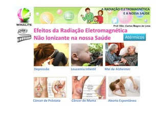 A RADIAÇÃO ELETROMAGNÉTICA
                                                      E A NOSSA SAÚDE


                                                Prof. DSc. Carlos Magno de Lima

Efeitos da Radiação Eletromagnética
Não Ionizante na nossa Saúde      Atérmicos




Depressão            Leucemia Infantil    Mal de Alzheimer




Câncer de Próstata   Câncer de Mama         Aborto Espontâneo
 