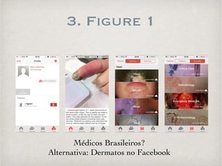 3. Figure 1 
Médicos Brasileiros? 
Alternativa: Dermatos no Facebook 
 