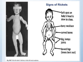 Theories of Mineralisation | PPTX