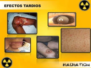EFECTOS TARDIOS
 