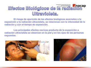 El riesgo de aparición de los efectos biológicos asociados a la
exposición a la radiación ultravioleta, se relacionan con la intensidad de la
radiación y con el tiempo de exposición.
Los principales efectos nocivos producto de la exposición a
radiación ultravioleta se observan en la piel y en los ojos de las personas
expuestas.
 