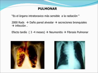 Radiacion | PPT