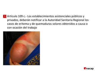 Artículo 109 c.- Los establecimientos asistenciales públicos y
privados, deberán notificar a la Autoridad Sanitaria Regional los
casos de eritema y de quemaduras solares obtenidos a causa o
con ocasión del trabajo
1
 