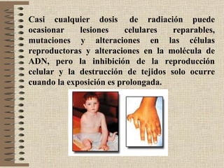 Casi cualquier dosis de radiación puede
ocasionar    lesiones     celulares  reparables,
mutaciones y alteraciones en las células
reproductoras y alteraciones en la molécula de
ADN, pero la inhibición de la reproducción
celular y la destrucción de tejidos solo ocurre
cuando la exposición es prolongada.
 
