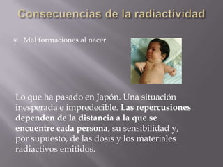    Mal formaciones al nacer




Lo que ha pasado en Japón. Una situación
inesperada e impredecible. Las repercusiones
dependen de la distancia a la que se
encuentre cada persona, su sensibilidad y,
por supuesto, de las dosis y los materiales
radiactivos emitidos.
 