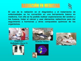 RADIACIÓN EN MEDICINAEl uso de la radiación en el diagnóstico y el tratamiento de enfermedades se ha convertido en una herramienta básica en medicina. Con ella se ha podido realizar exploraciones del cerebro y los huesos, tratar el cáncer y usar elementos radiactivos para dar seguimiento a hormonas y otros compuestos químicos de los organismos. Medicina NuclearDiagnóstico Radiológico (Rayos X)Radioterapia