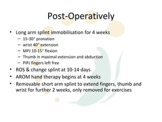 Post-Operatively
• Long arm splint immobilisation for 4 weeks
   –   15-30° pronation
   –   wrist 40° extension
   –   MPJ 10-15° flexion
   –   Thumb in maximal extension and abduction
   –   PIPJ fingers left free
• ROS & change splint at 10-14 days
• AROM hand therapy begins at 4 weeks
• Removable short arm splint to extend fingers, thumb and
  wrist for further 2 weeks, only removed for exercises
 