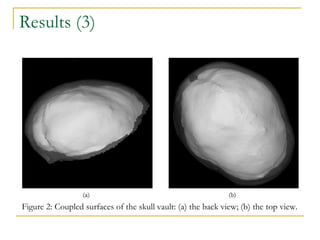 Results (3) Figure 2: Coupled surfaces of the skull vault: (a) the back view; (b) the top view. 
