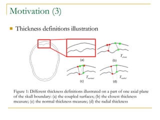 Motivation (3) Thickness definitions illustration Figure 1: Different thickness definitions illustrated on a part of one axial plane of the skull boundary: (a) the coupled surfaces; (b) the closest thickness measure; (c) the normal thickness measure; (d) the radial thickness 