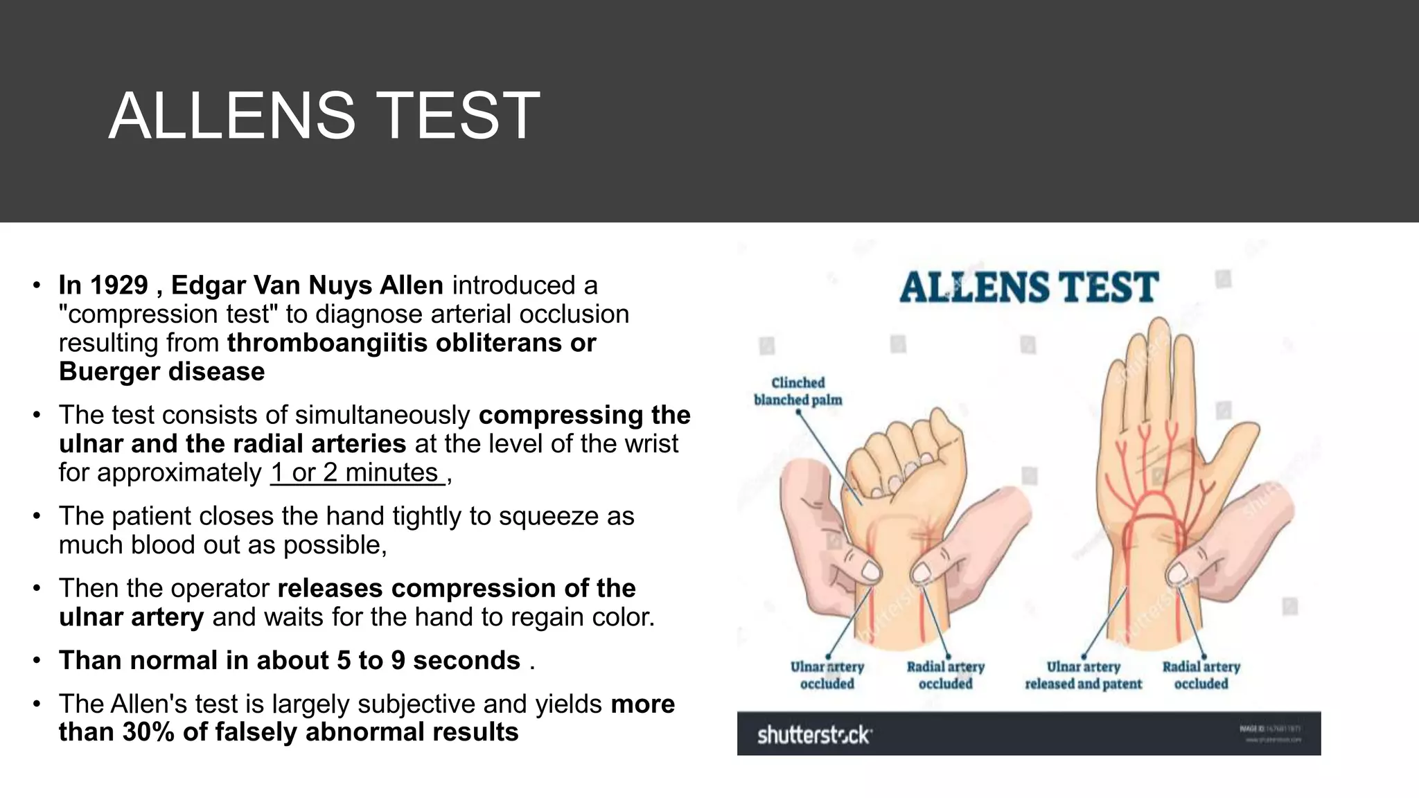 ALLENS TEST
• In 1929 , Edgar Van Nuys Allen introduced a
"compression test" to diagnose arterial occlusion
resulting from thromboangiitis obliterans or
Buerger disease
• The test consists of simultaneously compressing the
ulnar and the radial arteries at the level of the wrist
for approximately 1 or 2 minutes ,
• The patient closes the hand tightly to squeeze as
much blood out as possible,
• Then the operator releases compression of the
ulnar artery and waits for the hand to regain color.
• Than normal in about 5 to 9 seconds .
• The Allen's test is largely subjective and yields more
than 30% of falsely abnormal results
 