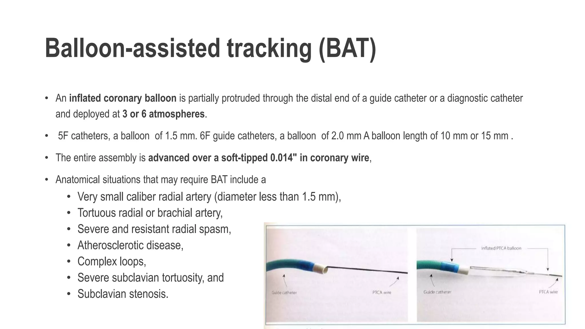 Balloon-assisted tracking (BAT)
• An inflated coronary balloon is partially protruded through the distal end of a guide catheter or a diagnostic catheter
and deployed at 3 or 6 atmospheres.
• 5F catheters, a balloon of 1.5 mm. 6F guide catheters, a balloon of 2.0 mm A balloon length of 10 mm or 15 mm .
• The entire assembly is advanced over a soft-tipped 0.014″ in coronary wire,
• Anatomical situations that may require BAT include a
• Very small caliber radial artery (diameter less than 1.5 mm),
• Tortuous radial or brachial artery,
• Severe and resistant radial spasm,
• Atherosclerotic disease,
• Complex loops,
• Severe subclavian tortuosity, and
• Subclavian stenosis.
 
