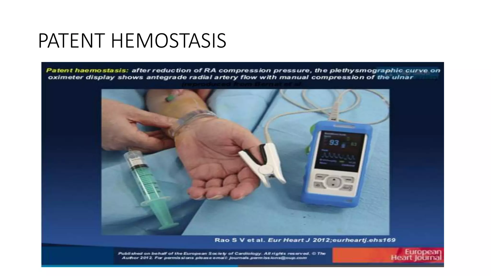 PATENT HEMOSTASIS
 