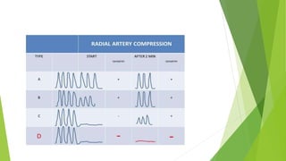 Radial artery access[1] | PPTX