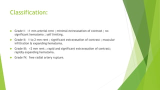 Radial artery access[1] | PPTX