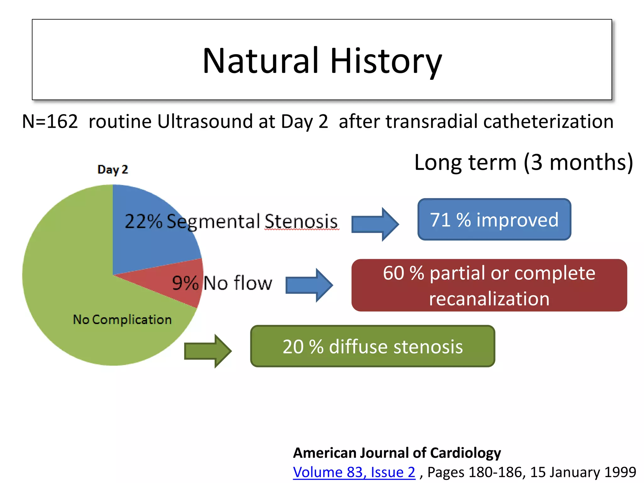 Natural History
71 % improved
20 % diffuse stenosis
60 % partial or complete
recanalization
Long term (3 months)
American Journal of Cardiology
Volume 83, Issue 2 , Pages 180-186, 15 January 1999
N=162 routine Ultrasound at Day 2 after transradial catheterization
 