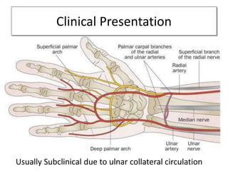 Radial artery patency after transradial catheterization | PPTX