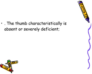 . The thumb characteristically is absent or severely deficient;  