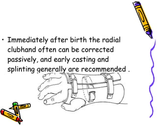 Immediately after birth the radial clubhand often can be corrected passively, and early casting and splinting generally are recommended .  