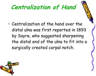 Centralization of Hand Centralization of the hand over the distal ulna was first reported in 1893 by Sayre, who suggested sharpening the distal end of the ulna to fit into a surgically created carpal notch.  